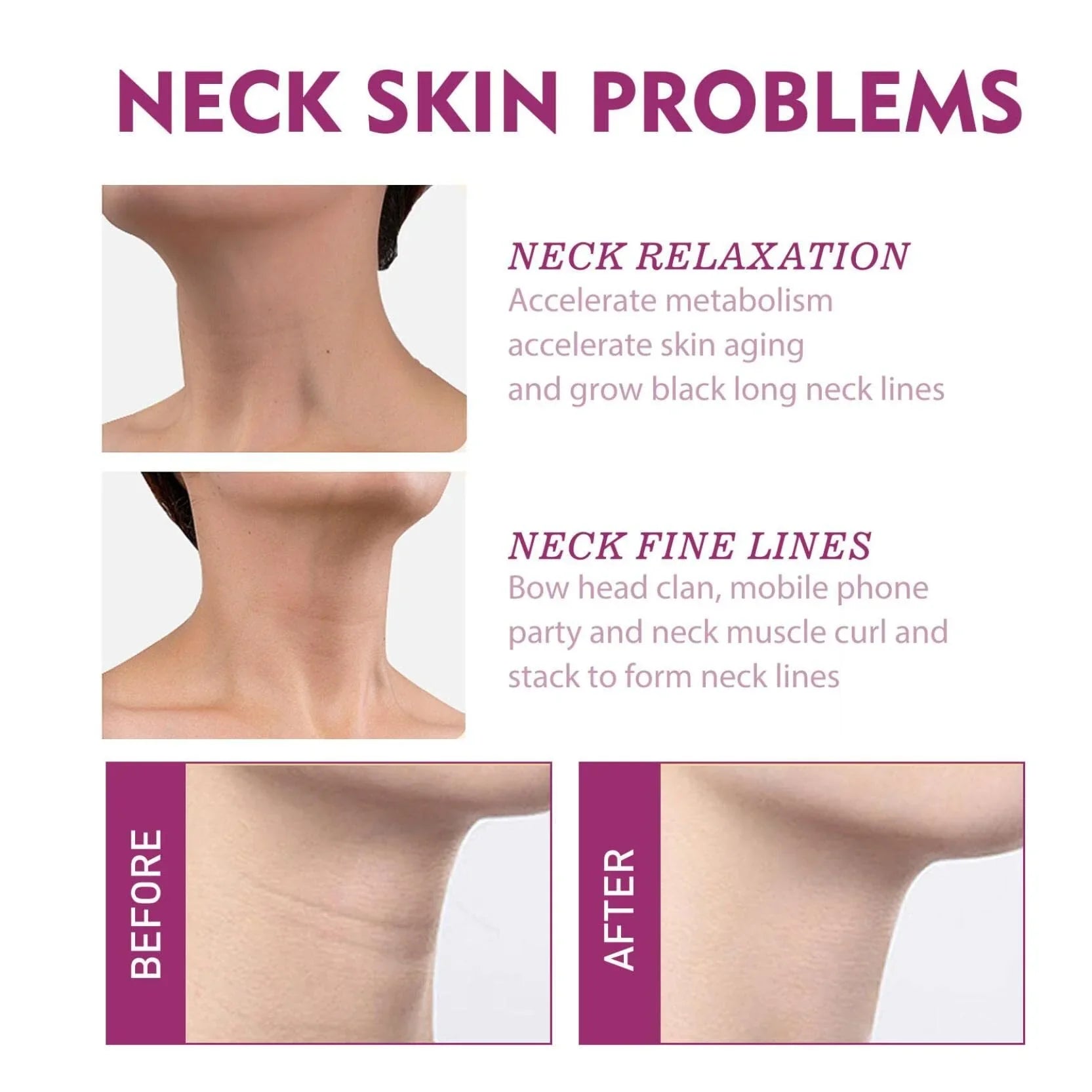 Collagen Neck Cream, Natural Hydrolyzed Collagen For Delay Sizekin Ageing,Wash-free neck cream, Collagen Neck Firming Cream,Ivoryns Sizewan Neck Beauty Neck Cream,7PCSize